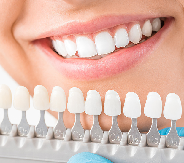 Is A Dental Filling Always Required For Cavities?