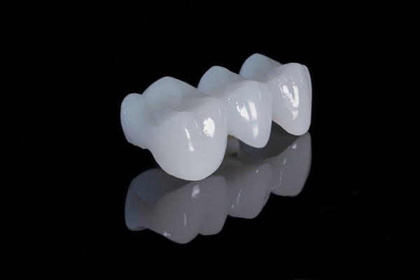 Tooth Replacement : Why A Dentist May Recommend A Dental Bridge